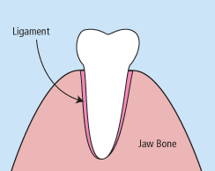 extractions teeth
